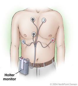 MFD Veselības grupa – Esi vesels! | Holter diennakts monitorēšana bez garām  rindām!